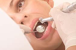 Improved Instructions for Nobel Direct Dental Implants